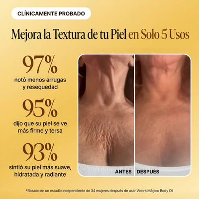 Velora™ Aceite Corporal de Lujo — 100ml