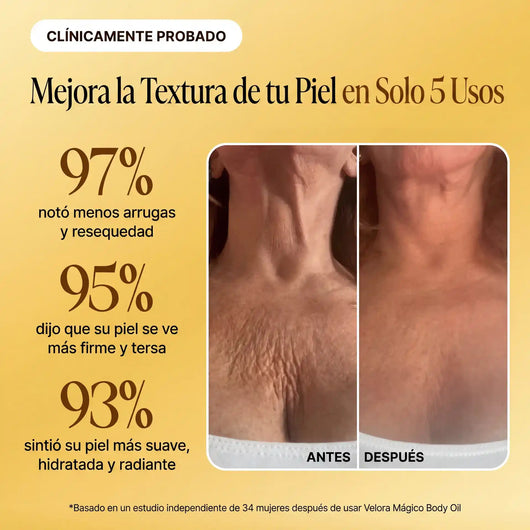 Velora™ Aceite Corporal de Lujo — 100ml