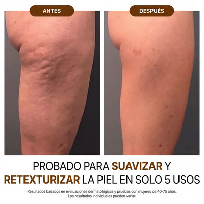 Velora™ Aceite Corporal de Lujo — 100ml