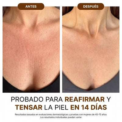 Velora™ Aceite Corporal de Lujo — 100ml