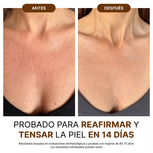Velora™ Aceite Corporal de Lujo — 100ml