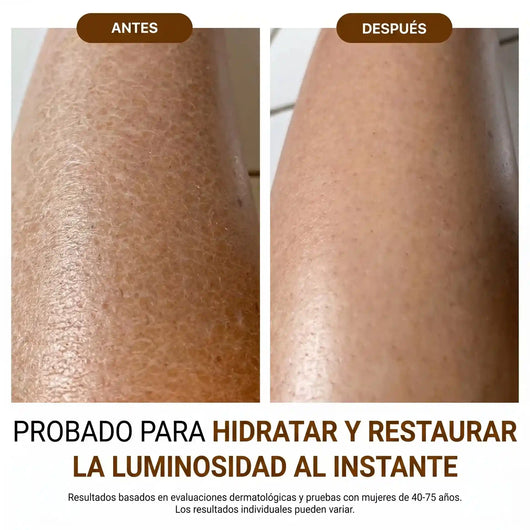 Velora™ Aceite Corporal de Lujo — 100ml