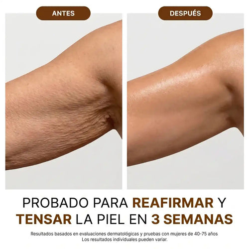 Velora™ Aceite Corporal de Lujo — 100ml