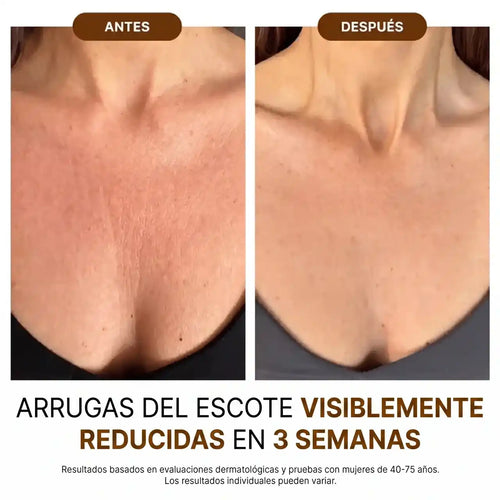 Velora™ Aceite Corporal de Lujo — 100ml